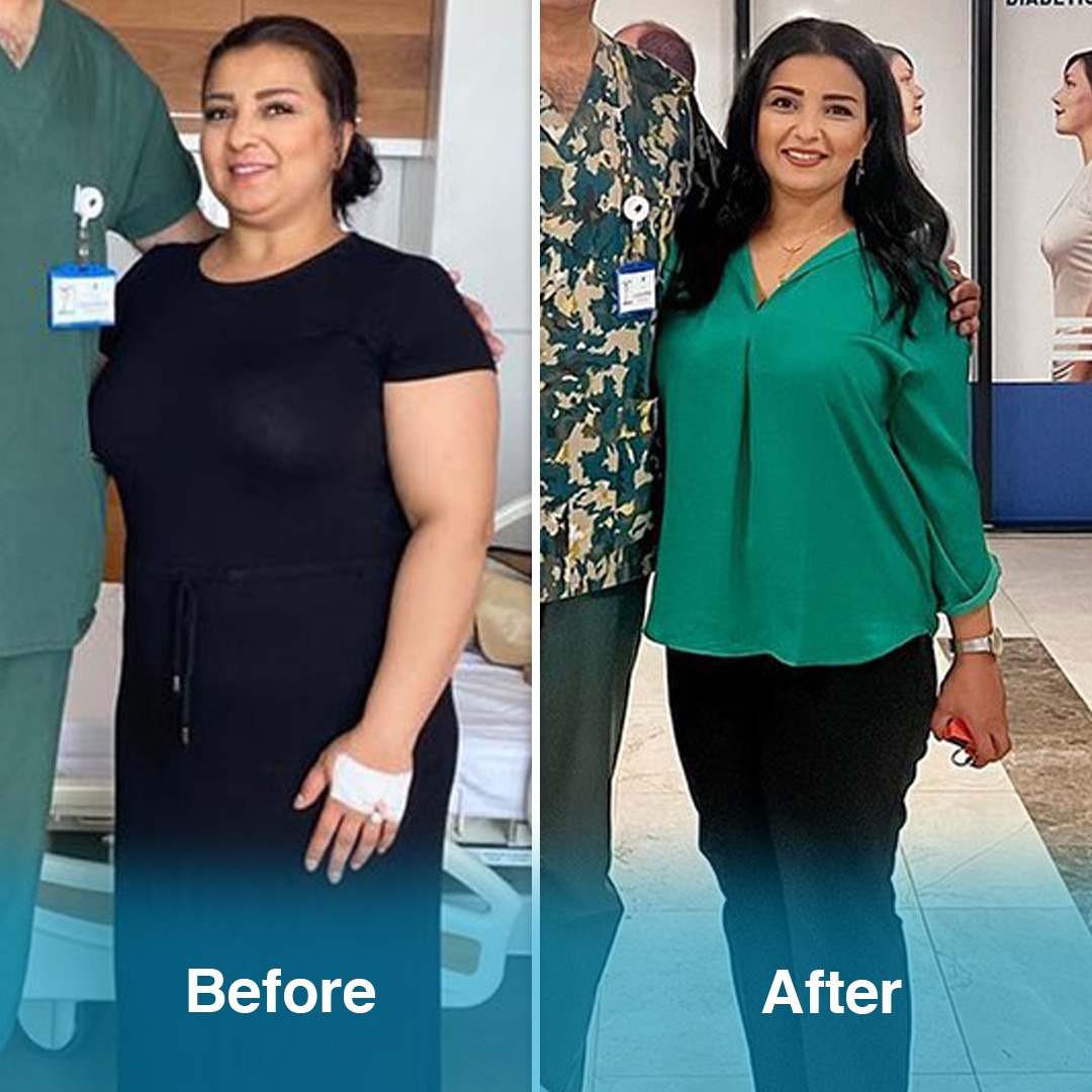Beforeafter1