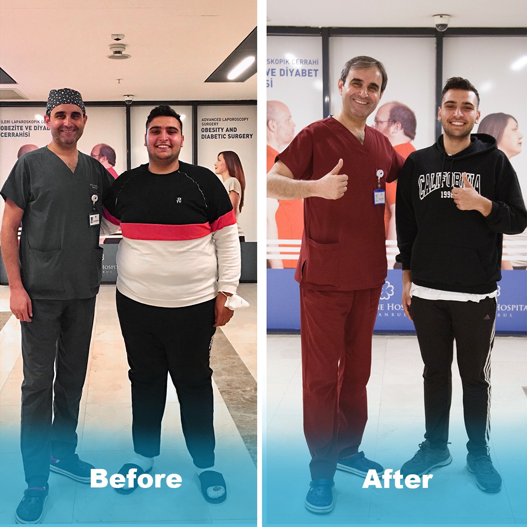 Beforeafter2