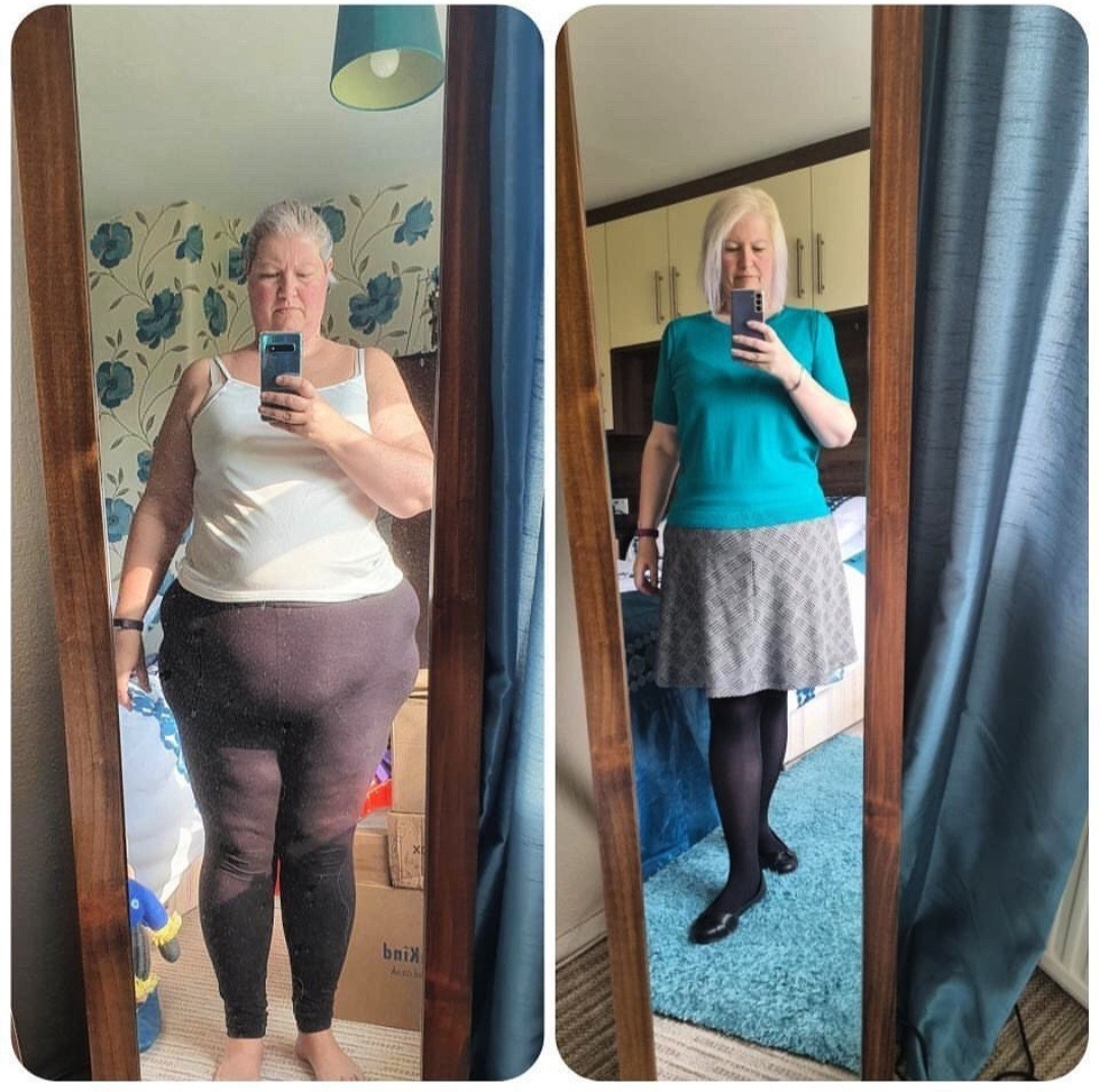Beforeafter3