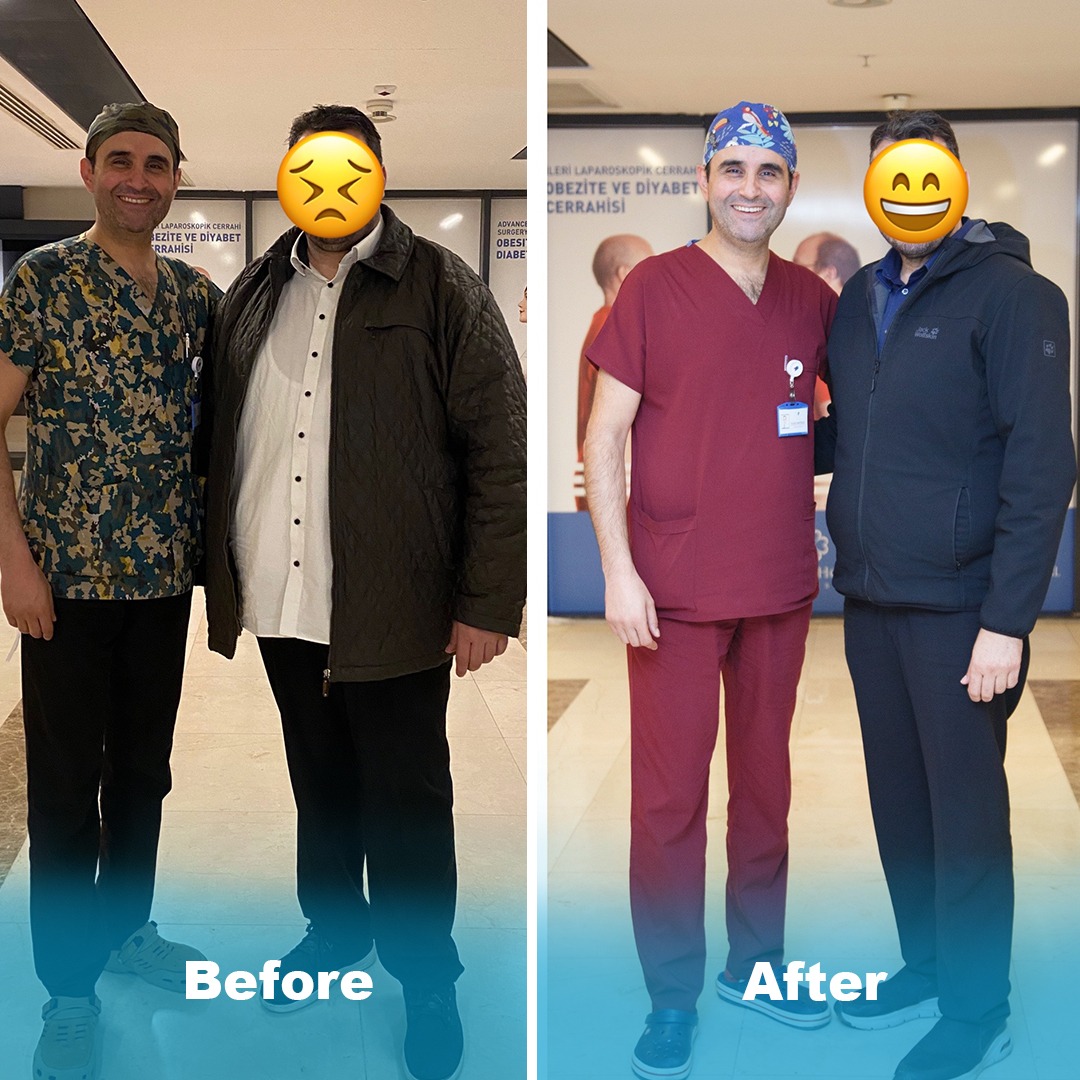 Beforeafter4